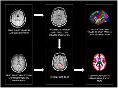 The key role of depression and supramarginal gyrus in frailty: a cross-sectional study